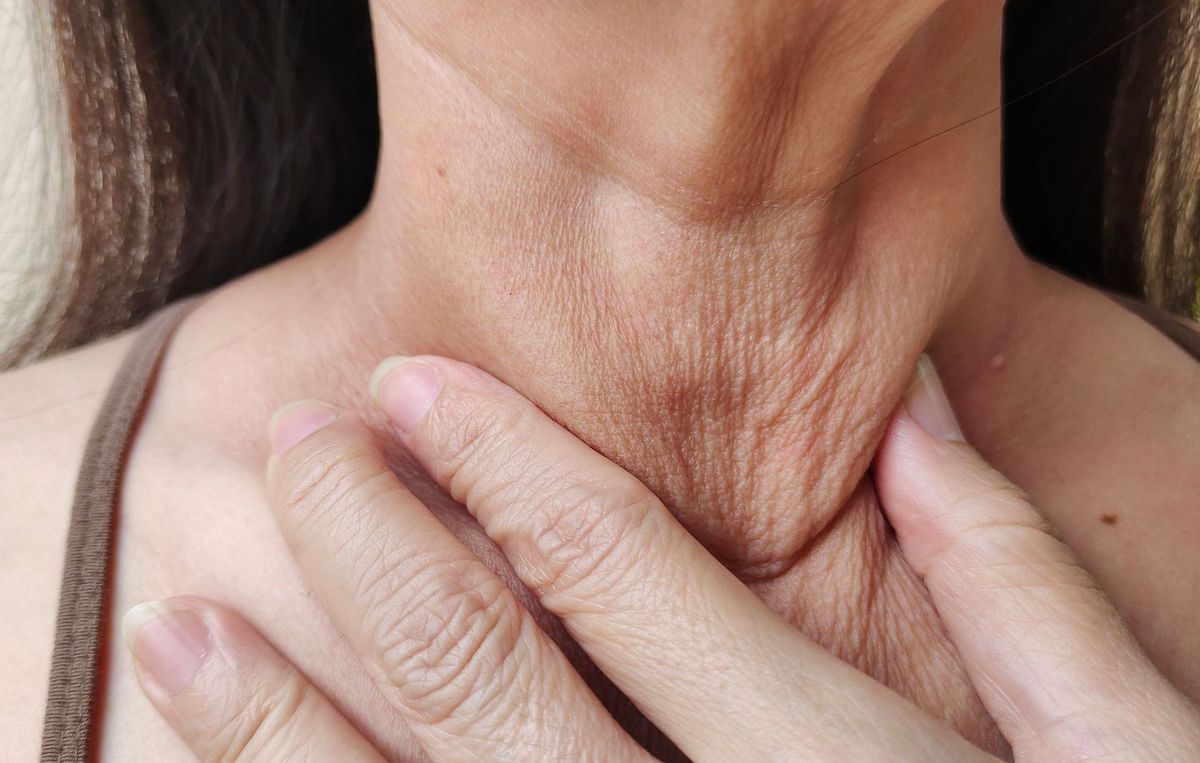 Close-up of crepey, lined skin on the neck caused by collagen loss